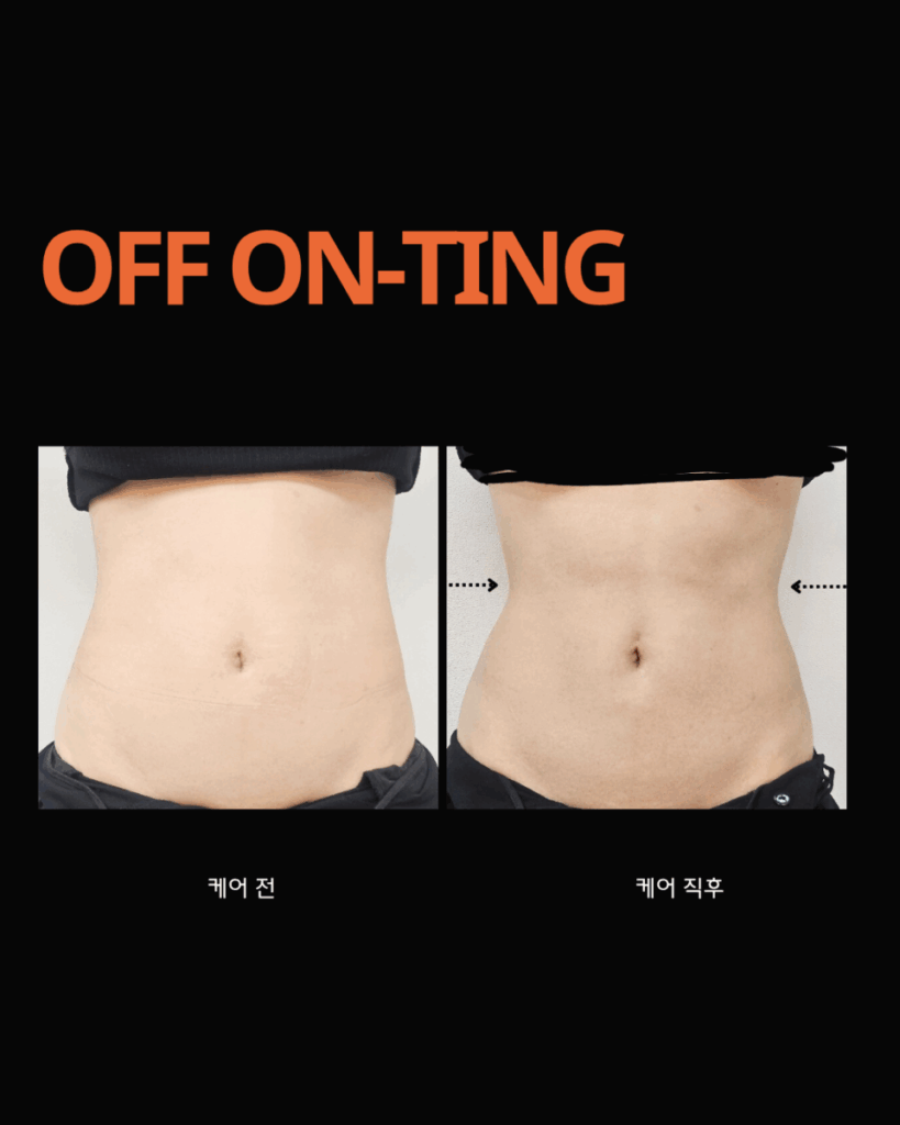 Black White Minimal Modern Simple Clean The Bakery Instagram Post 20251023 093636 0000